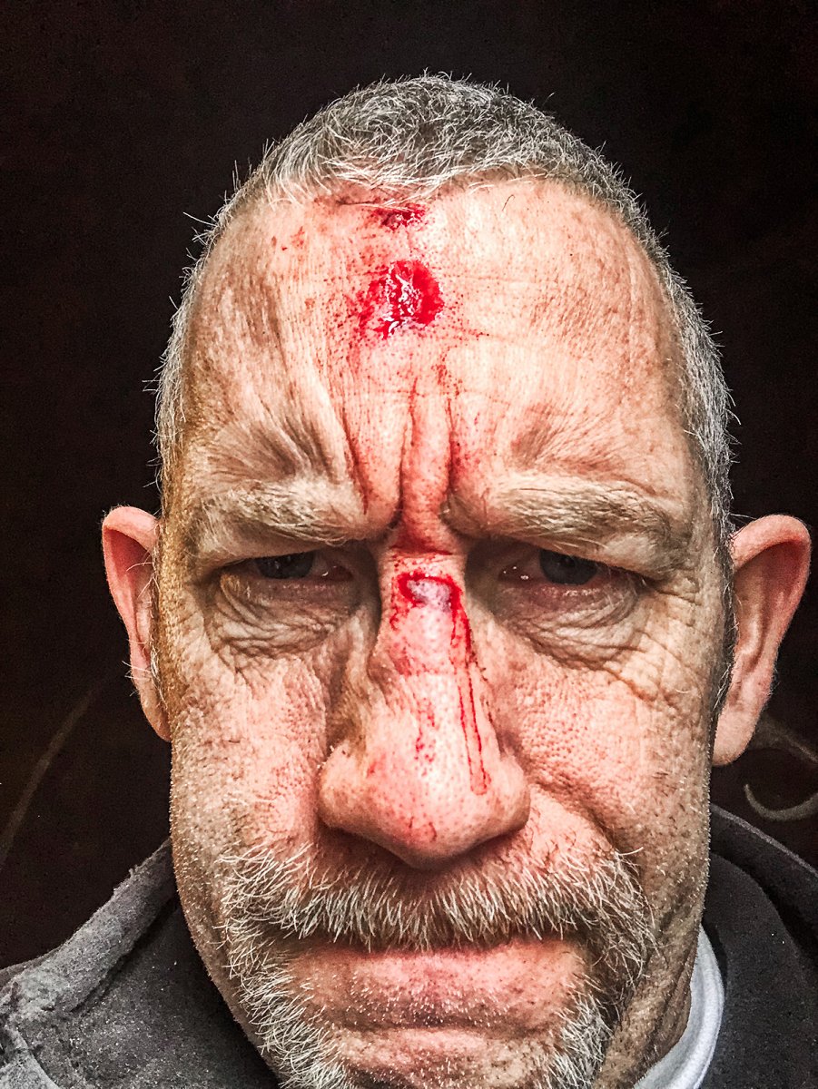 self inflicted injuries