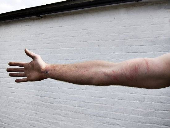 self harming gardener