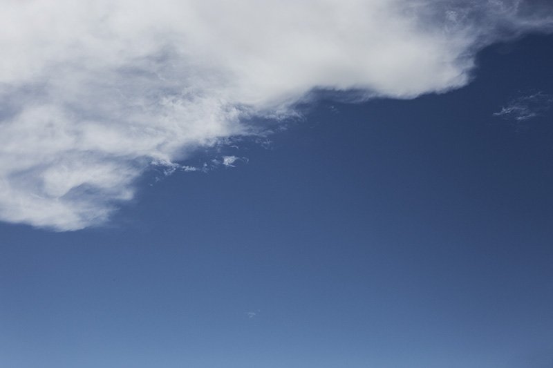 meralgia paresthetica